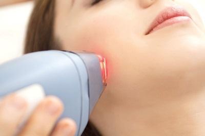 Laser hair removal on face.